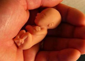 هفت علت اصلی عوامل بروز سقط جنین