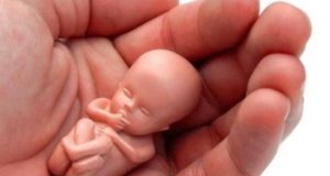 از بین رفتن ورم سینه و تهوع علامتی برای سقط جنین